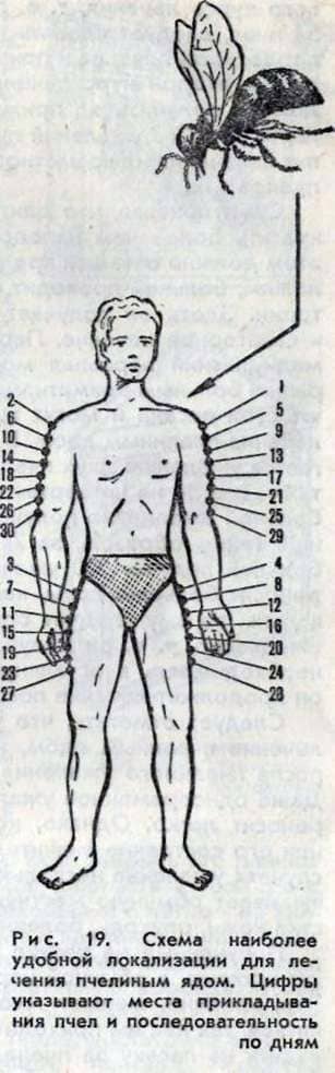 Places of treatment by bee stings