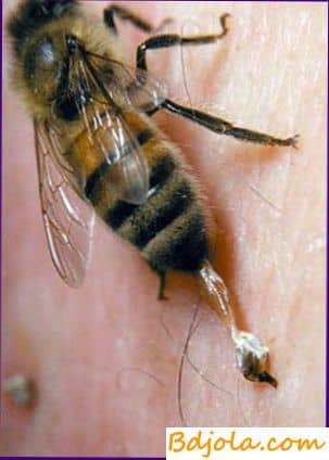 Aplicación del veneno de abeja